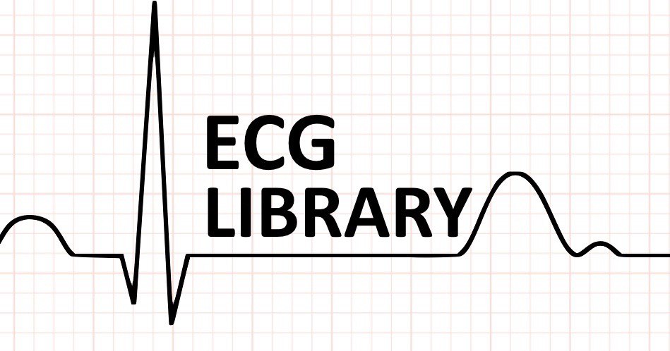 Экг тренировка. Ecg864. LITFL. Уменьшение комплекса QRS. ECG Basics — free.